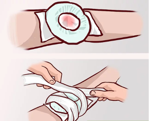 how to use bandage